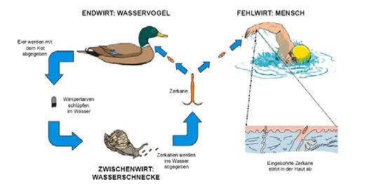 Schaubild Badedermatitis-Kreislauf: Wasservogel mit Zerkarien, Wasserschnecke als Zwischenwirt und Mensch im Wasser. Blaue Pfeile zeigen Übertragungswege.
