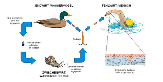 Schematische Darstellung der Übertragung von Badedermatitis. 