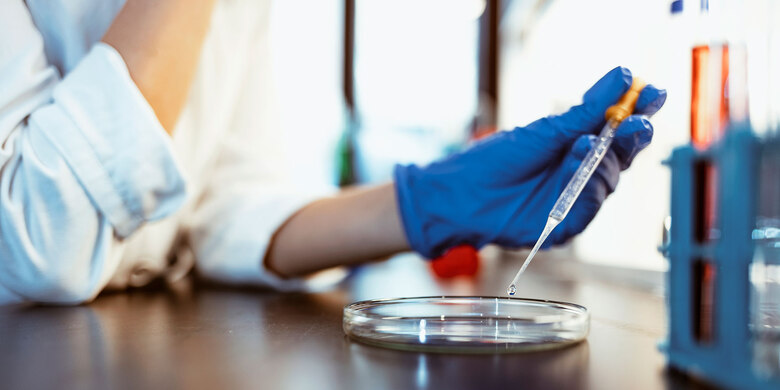 Laborarbeit: Hand mit blauem Handschuh hält Pipette über Petrischale. Probenentnahme im medizinischen Labor.
