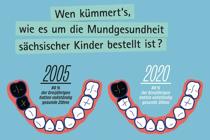 Infografik Mundgesundheit: Vergleich kariöser Zähne bei Dreijährigen 2005 (80%) und 2020 (88%). Zahnschema mit gesunden und kariösen Zähnen.