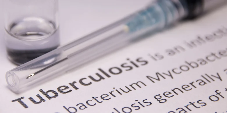 Laborutensilien zur Tuberkulosediagnostik: Reagenzglas und medizinische Fachbegriffe wie Mycobacterium tuberculosis symbolisieren die bakteriologische Untersuchung.
